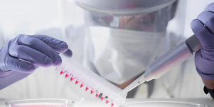 3 معلومات مهمة عن تحليل CBC