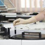 2 من أهم المعلومات عن تحليل HCV