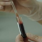 أهم 19 سبب لإرتفاع كريات الدم البيضاء