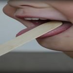 كيف تعالج الدمل؟ 4 خطوات للتخلص من الدمامل في الجسم