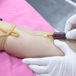 3 أسباب لزيادة سرعة الترسيب