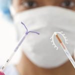طريقة تركيب اللولب في 6 خطوات