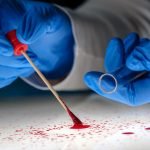 ماذا يرمز الى hypochromia, microcytosis بتحليل الدم؟ 3 مصطلحات