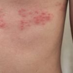 11 حقائق عن الحزام الناري