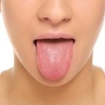 5 نصائح للعلاج والوقاية من التهاب اللسان .. تعرف عليها