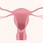 6 معلومات مهمة عن الرحم المقلوب