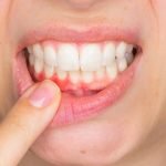 1 فائدة علاجية لدواء هيكسيتول