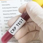 5 أمراض متوقعة لنتيجة تحليل crp