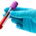ماذا تعرف عن تحليل الغدة الدرقية؟ أهم 5 معلومات عن نتائجه وما تشير إليه