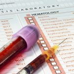 8 معلومات عن اختبارات hcv ab