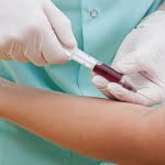 ما هو تحليل albumin creatinine ratio ؟ تعرف على أهم 4 معلومات هامة عنه