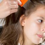 10 طرق طبيعية لعلاج قمل الرأس .. تعرف عليها