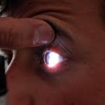 علاج أبو صفار