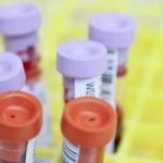 6 معلومات طبية حول تحليل INR .. أحد أهم تحليل الدم