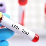 3 معلومات مهمة عن تحليل LDH