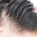 تفسير سقوط الشعر في المنام .. 5  تفسيرات من كتب التفسير