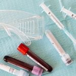 3 معلومات مهمة عن تحليل الدم CRP