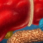 ما هي أعراض فيروس سي وعلاجه .. 17 من أهم أعراضه القوية الظاهرة