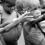 8 جوانب صحية حول سوء التغذية عند الإنسان