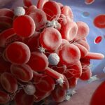 ماذا تعرف عن تخثر الدم؟ 4 معلومات طبية عنه