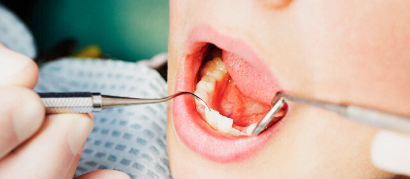 Dubai launches dental checks, awareness drive for private school students